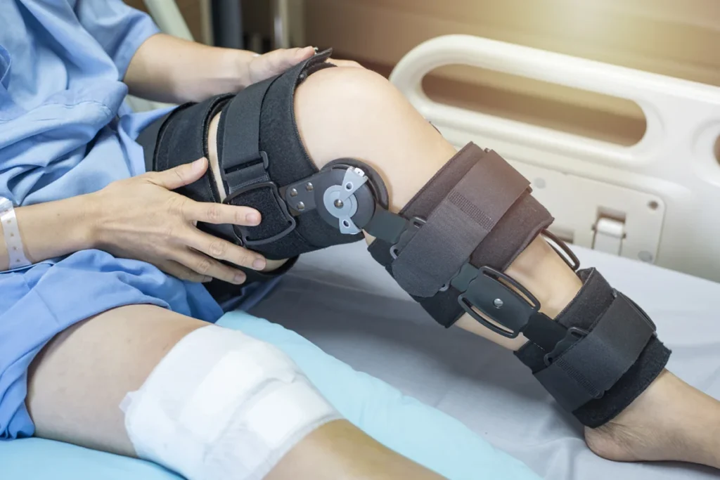 Knee Replacement Surgery Recovery