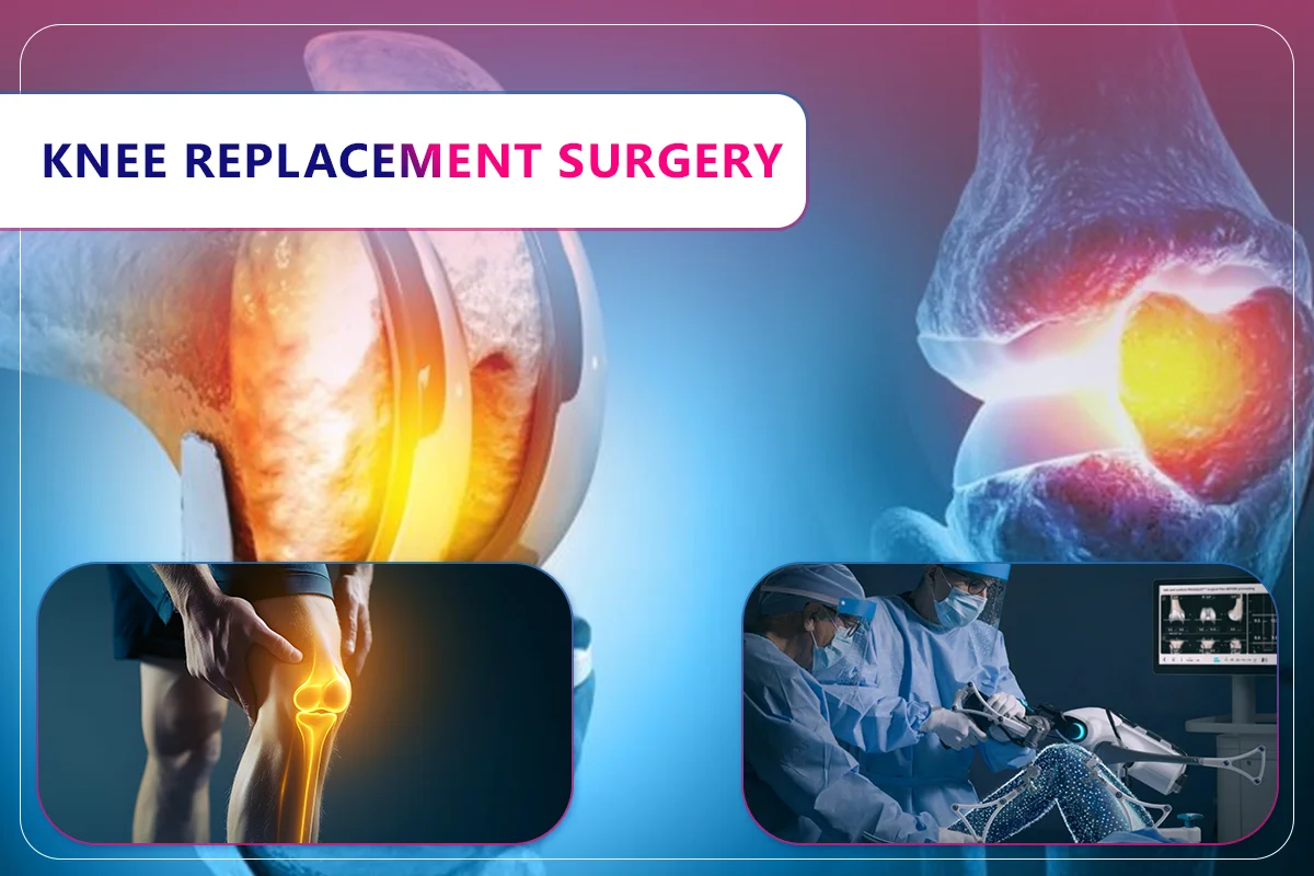 Knee Replacement Surgery