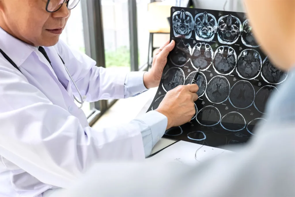 Neurologist in Thailand