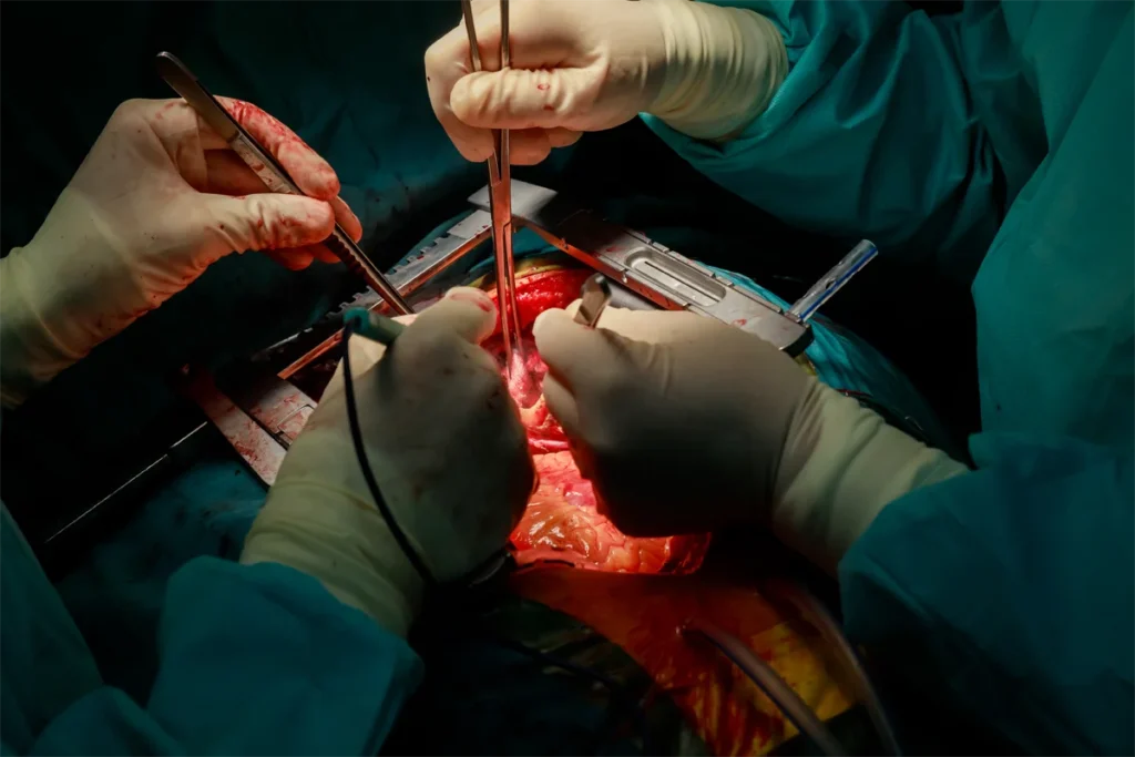 Open Heart Surgery in Thailand