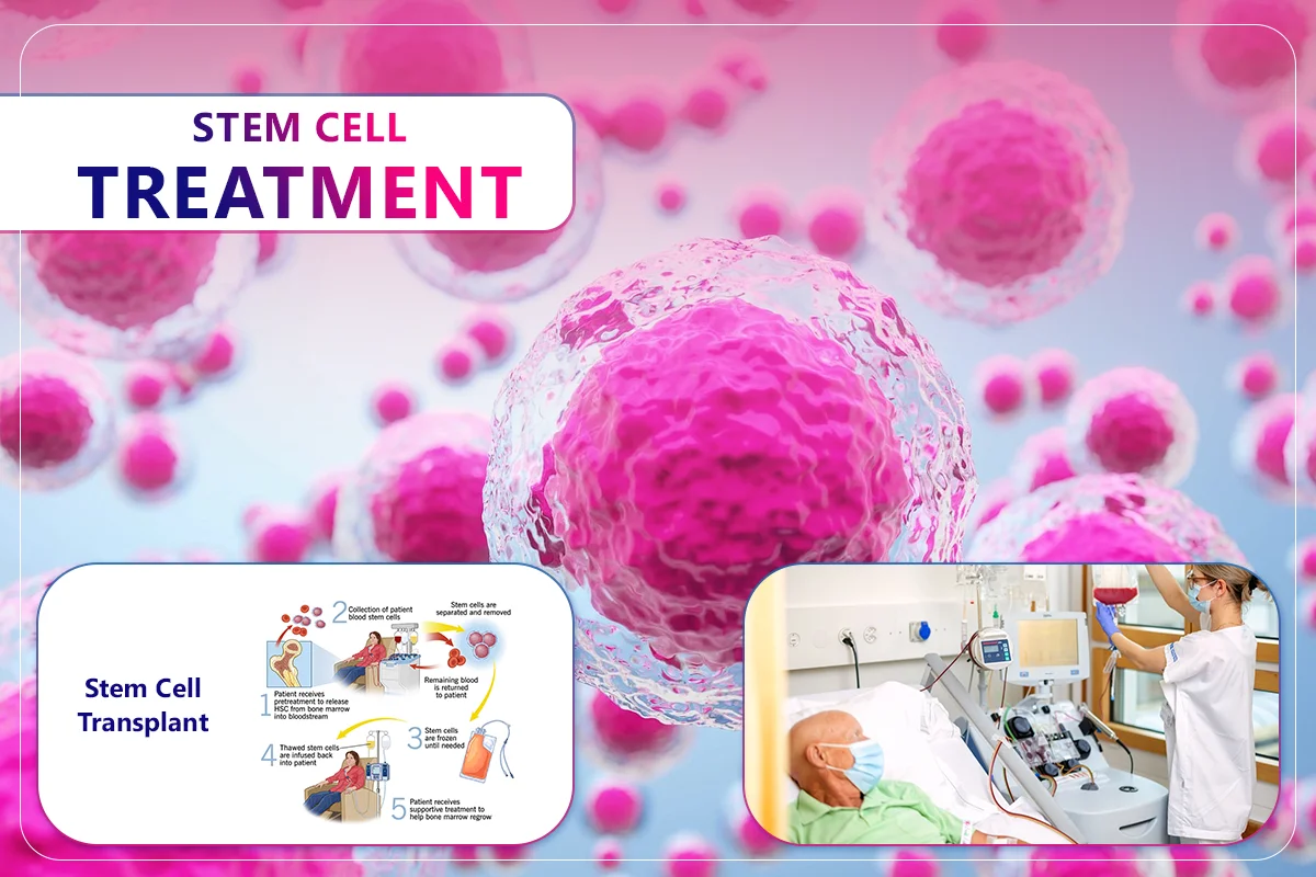 Stem Cell Transplant