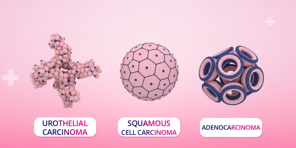 Bladder Cancer -Thaimedics