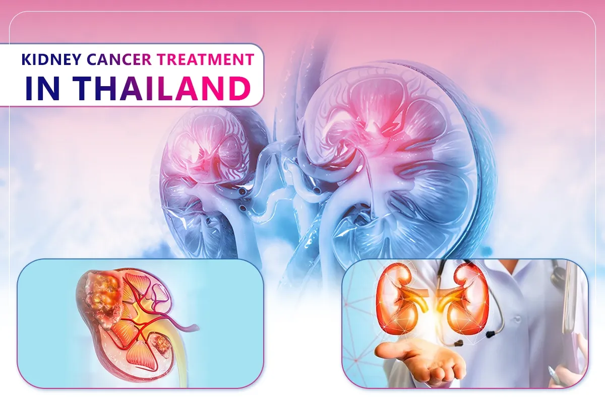kidney cancer treatment