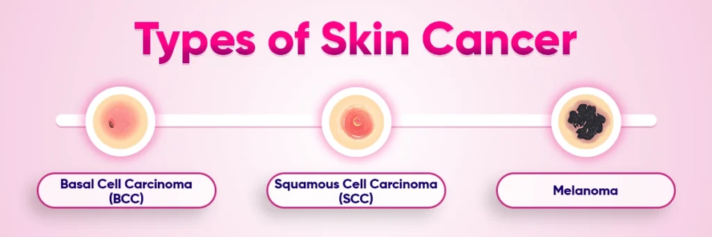 types-of-skin-cancer