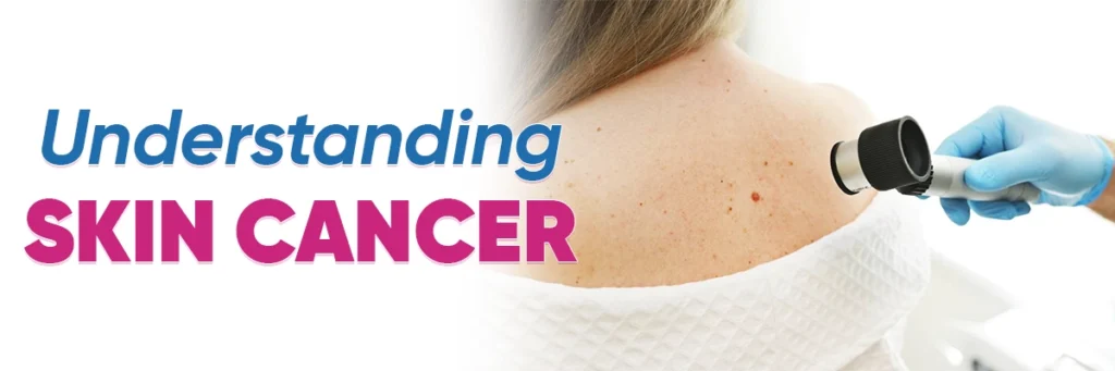 understanding-types-of-skin-cancer