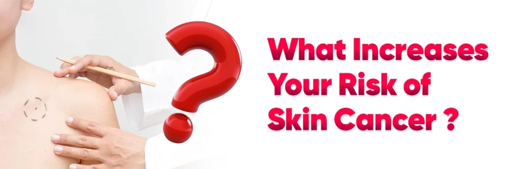 Question about skin cancer risk factors