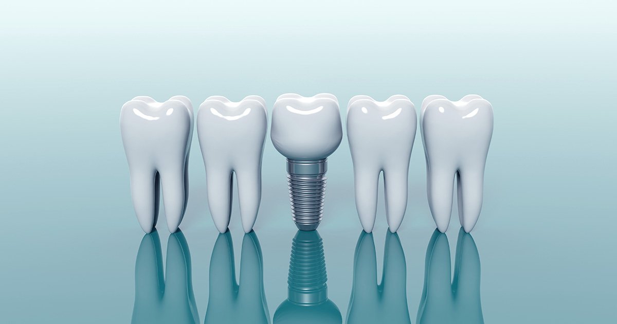 IHL Cn Dental Implant